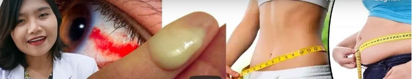 10 Gejala Gula Darah Tinggi, Diabetes. Sepele tapi Bahaya! (Emasuperr)