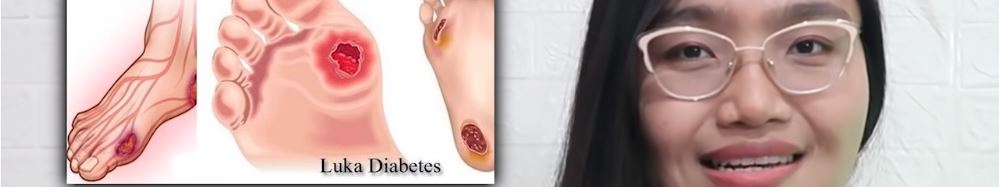 Periksa Kaki Diabetes (Emasuperr)
